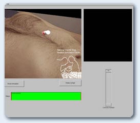 Screen capture of pericardiocentesis simulator
